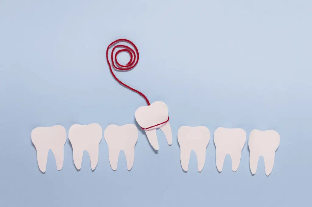 Wisdom Teeth Removal Guide 剝智慧齒重點