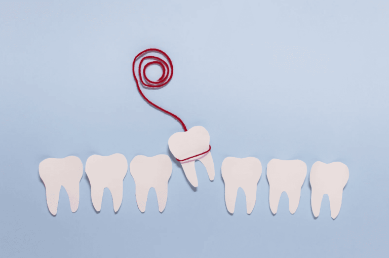 Wisdom Teeth Removal Guide 剝智慧齒重點