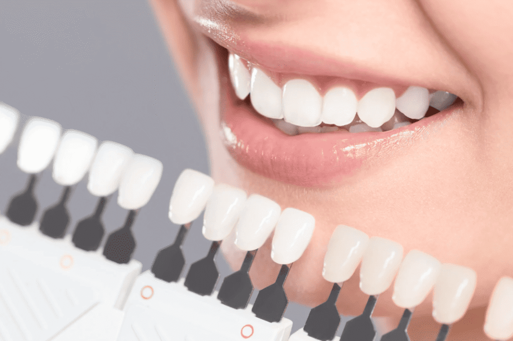 Blue light teeth whitening process 藍光美白牙齒過程