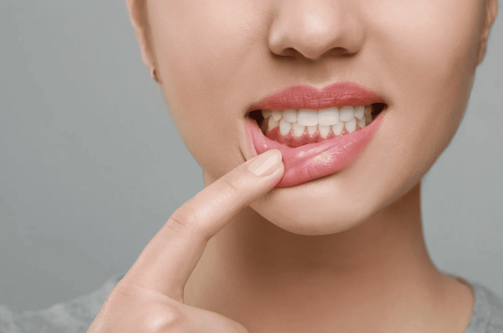 Guide to Gum Disease 牙周病全面解析