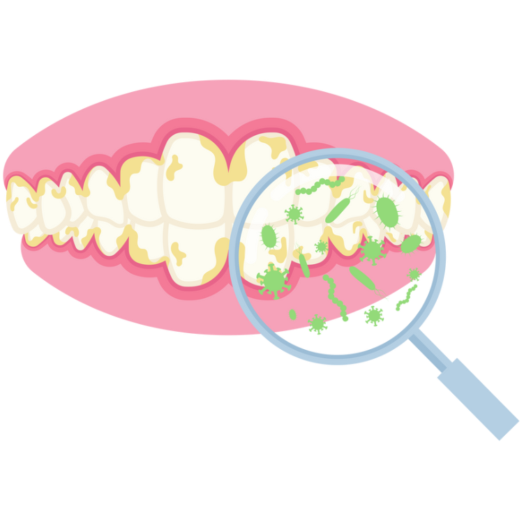 Prevent Gum Disease 預防牙周病