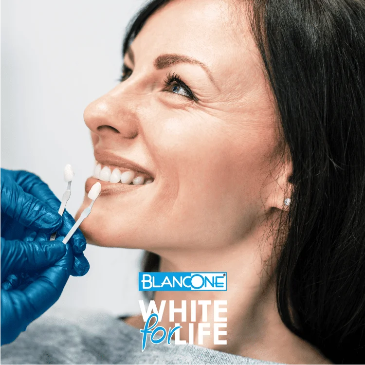 BlancOne-Whitening-美白牙齒方案