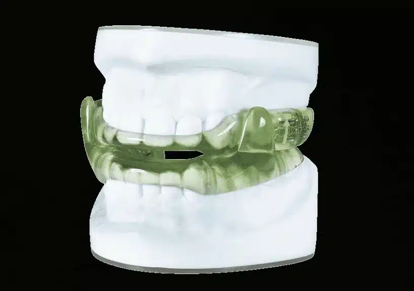 anti-snoring-device-serene-silensor-防打鼻鼾裝置-靜斯